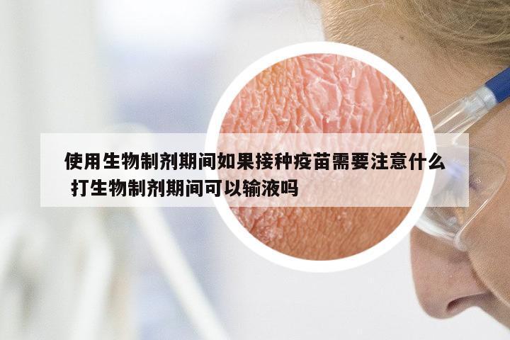 使用生物制剂期间如果接种疫苗需要注意什么 打生物制剂期间可以输液吗