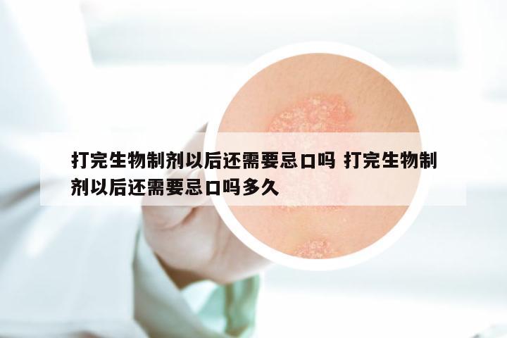 打完生物制剂以后还需要忌口吗 打完生物制剂以后还需要忌口吗多久