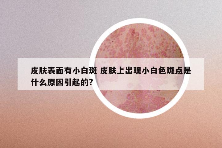 皮肤表面有小白斑 皮肤上出现小白色斑点是什么原因引起的?