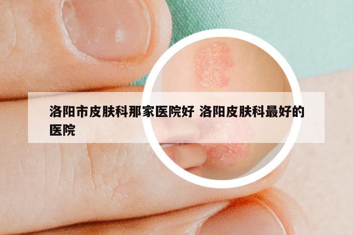 洛阳市皮肤科那家医院好 洛阳皮肤科最好的医院