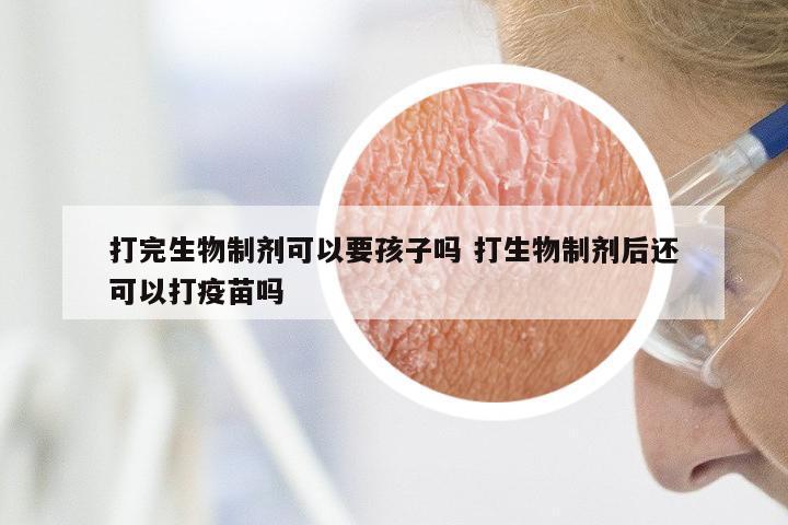 打完生物制剂可以要孩子吗 打生物制剂后还可以打疫苗吗