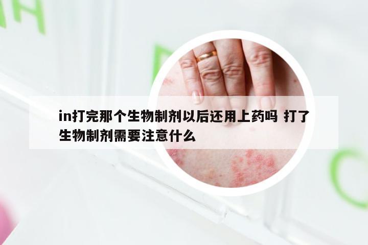 in打完那个生物制剂以后还用上药吗 打了生物制剂需要注意什么