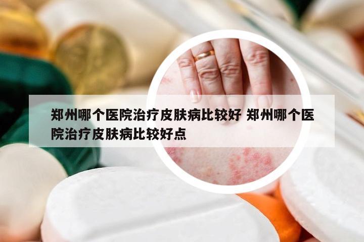 郑州哪个医院治疗皮肤病比较好 郑州哪个医院治疗皮肤病比较好点