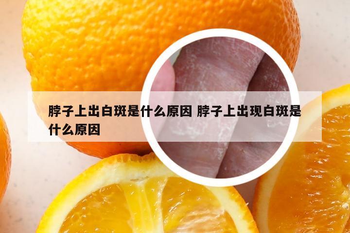 脖子上出白斑是什么原因 脖子上出现白斑是什么原因