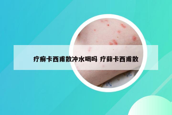 疗癣卡西甫散冲水喝吗 疗藓卡西甫散