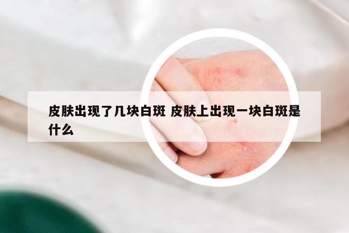 皮肤出现了几块白斑 皮肤上出现一块白斑是什么