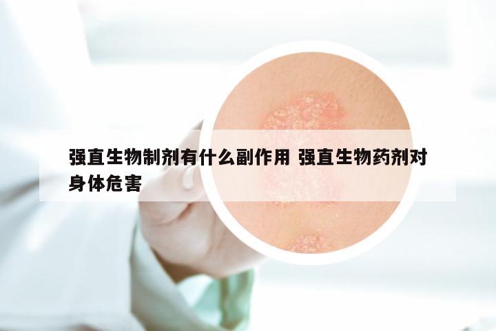 强直生物制剂有什么副作用 强直生物药剂对身体危害