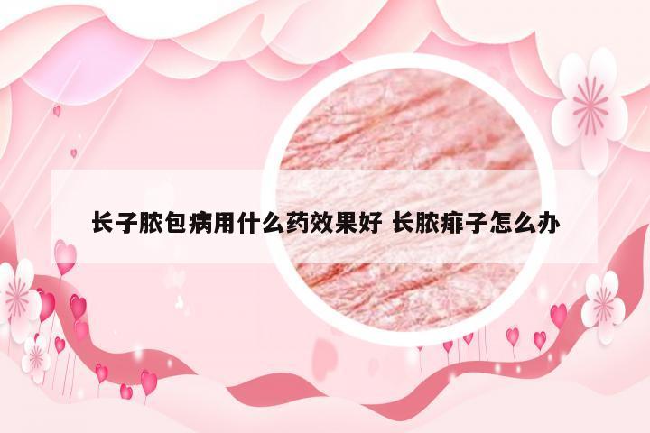 长子脓包病用什么药效果好 长脓痱子怎么办