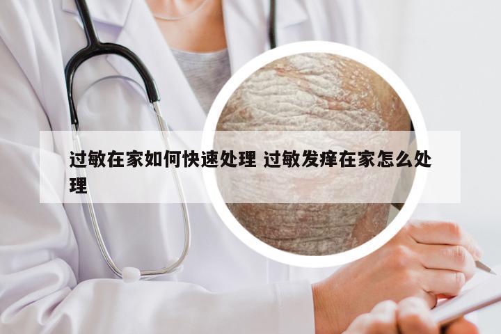 过敏在家如何快速处理 过敏发痒在家怎么处理