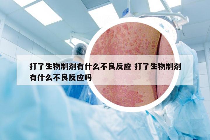 打了生物制剂有什么不良反应 打了生物制剂有什么不良反应吗