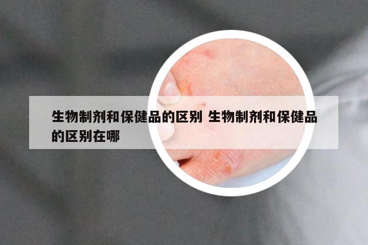 生物制剂和保健品的区别 生物制剂和保健品的区别在哪