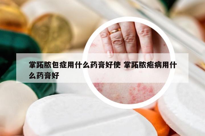 掌跖脓包症用什么药膏好使 掌跖脓疱病用什么药膏好