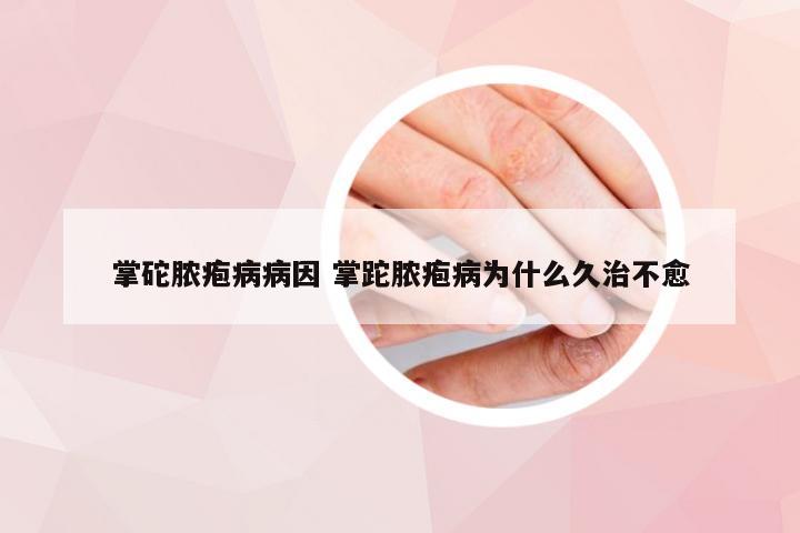 掌砣脓疱病病因 掌跎脓疱病为什么久治不愈