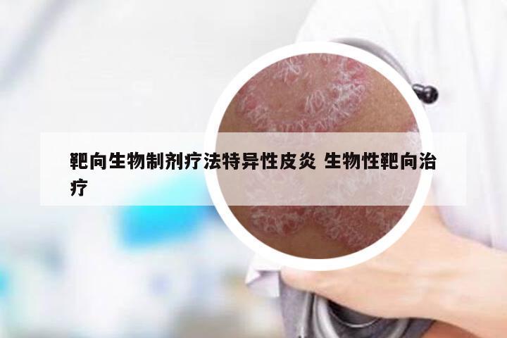 靶向生物制剂疗法特异性皮炎 生物性靶向治疗