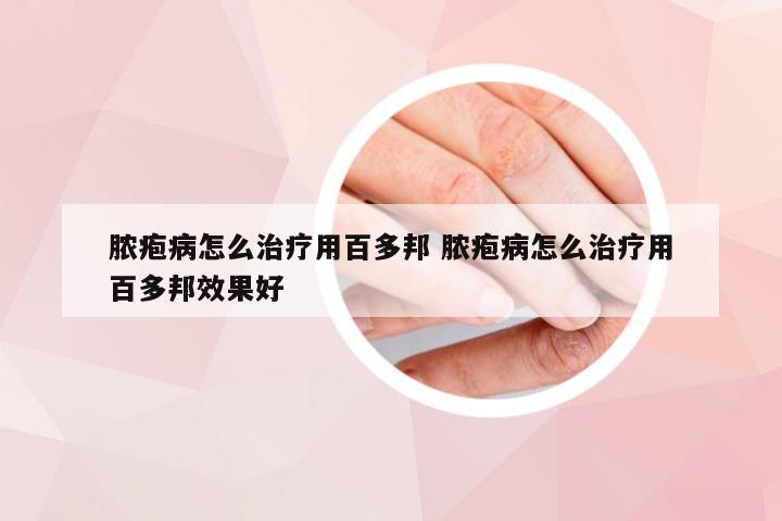 脓疱病怎么治疗用百多邦 脓疱病怎么治疗用百多邦效果好