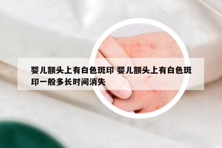 婴儿额头上有白色斑印 婴儿额头上有白色斑印一般多长时间消失