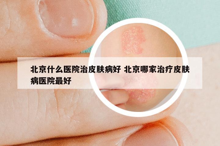 北京什么医院治皮肤病好 北京哪家治疗皮肤病医院最好