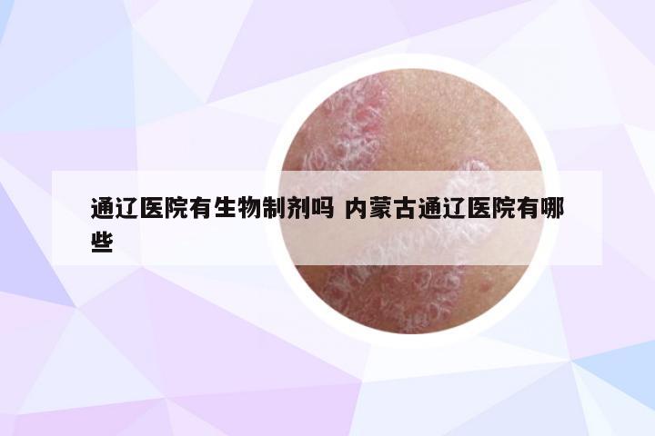 通辽医院有生物制剂吗 内蒙古通辽医院有哪些