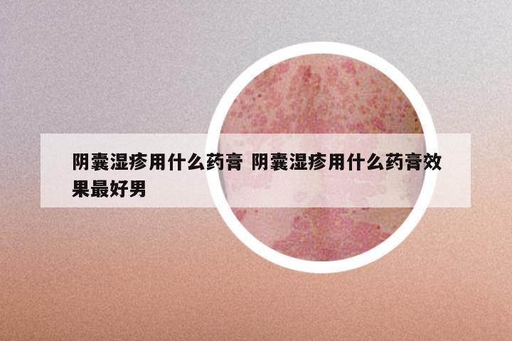 阴囊湿疹用什么药膏 阴囊湿疹用什么药膏效果最好男