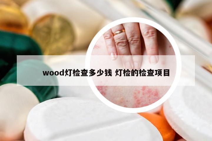 wood灯检查多少钱 灯检的检查项目