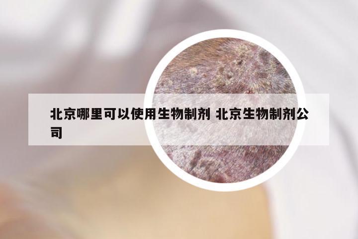 北京哪里可以使用生物制剂 北京生物制剂公司