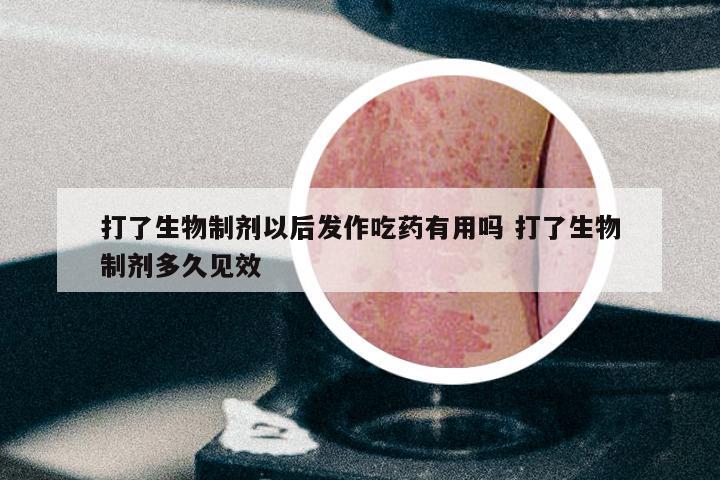 打了生物制剂以后发作吃药有用吗 打了生物制剂多久见效