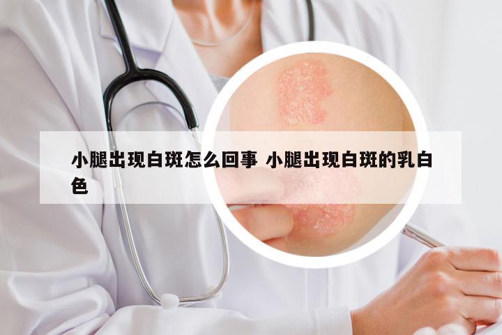 小腿出现白斑怎么回事 小腿出现白斑的乳白色