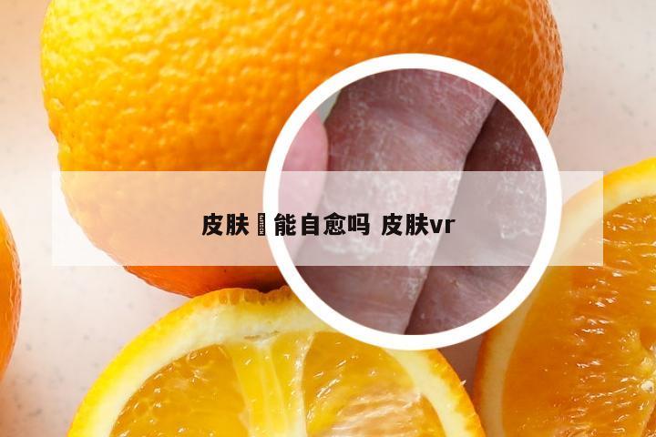 皮肤廯能自愈吗 皮肤vr