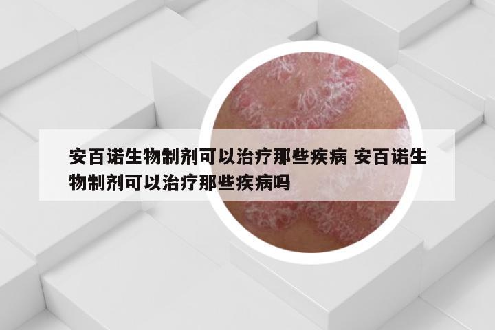 安百诺生物制剂可以治疗那些疾病 安百诺生物制剂可以治疗那些疾病吗