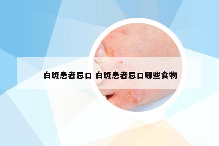 白斑患者忌口 白斑患者忌口哪些食物