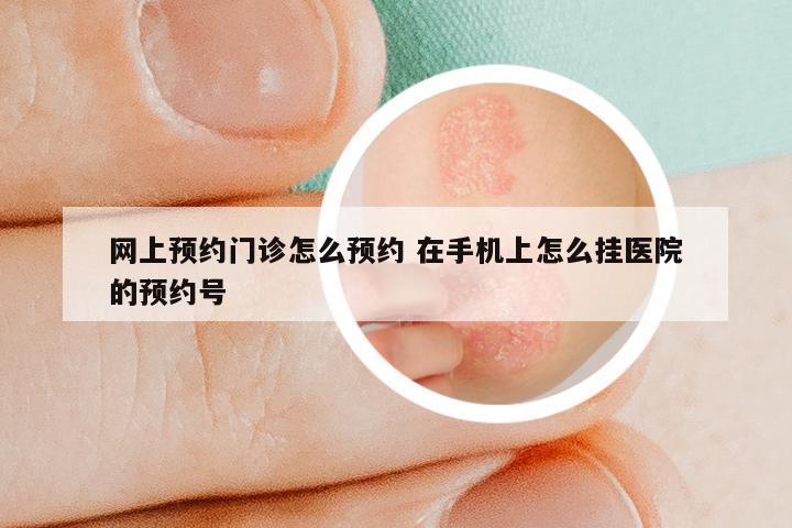 网上预约门诊怎么预约 在手机上怎么挂医院的预约号