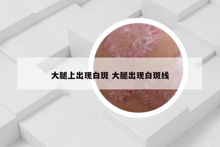 大腿上出现白斑 大腿出现白斑线