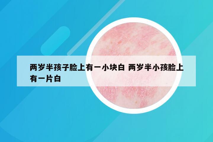 两岁半孩子脸上有一小块白 两岁半小孩脸上有一片白