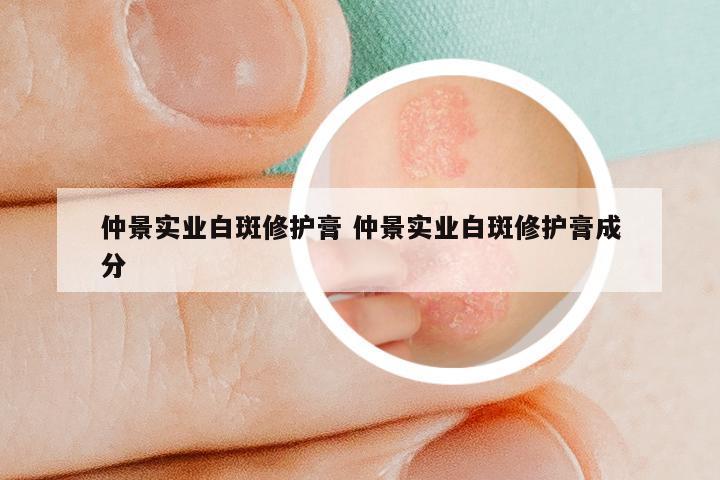 仲景实业白斑修护膏 仲景实业白斑修护膏成分