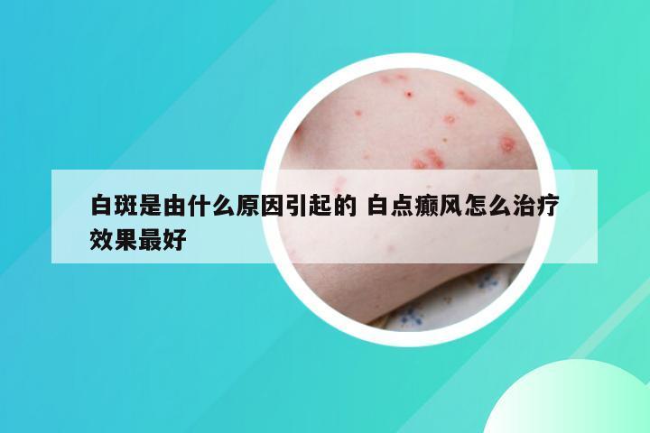 白斑是由什么原因引起的 白点癫风怎么治疗效果最好