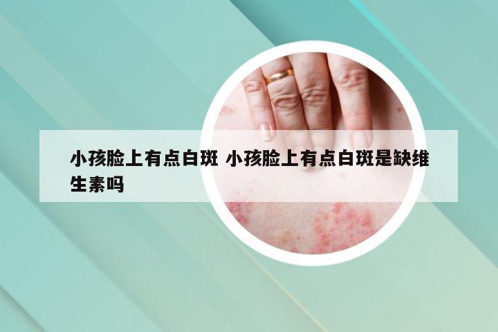 小孩脸上有点白斑 小孩脸上有点白斑是缺维生素吗