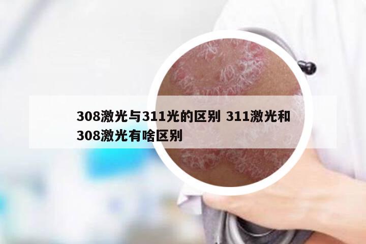 308激光与311光的区别 311激光和308激光有啥区别