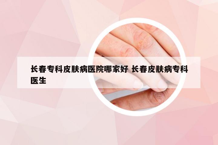 长春专科皮肤病医院哪家好 长春皮肤病专科医生