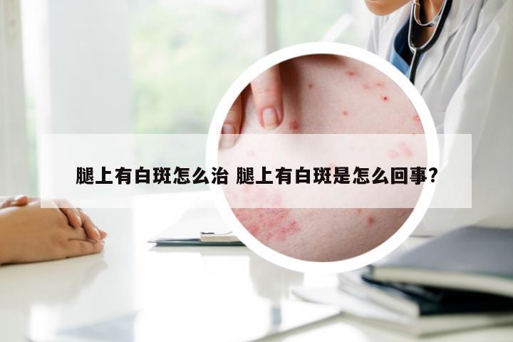 腿上有白斑怎么治 腿上有白斑是怎么回事?