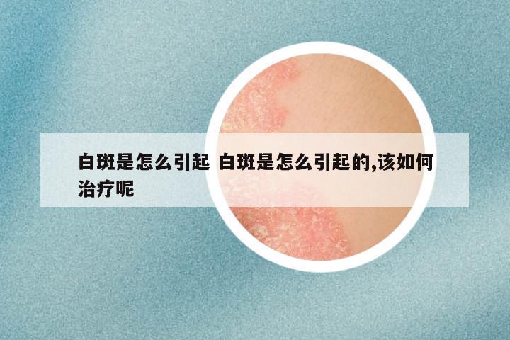 白斑是怎么引起 白斑是怎么引起的,该如何治疗呢