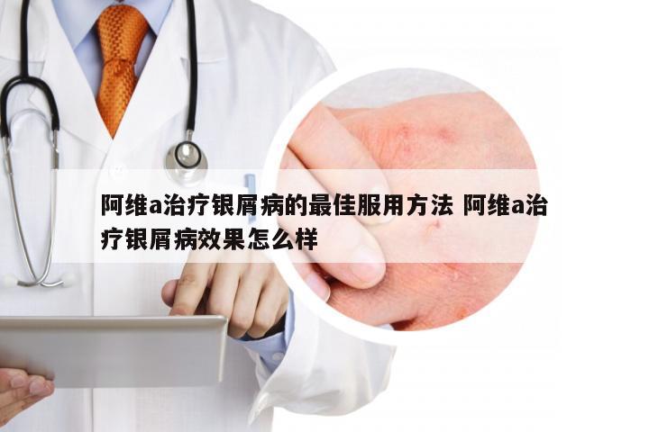 阿维a治疗银屑病的最佳服用方法 阿维a治疗银屑病效果怎么样