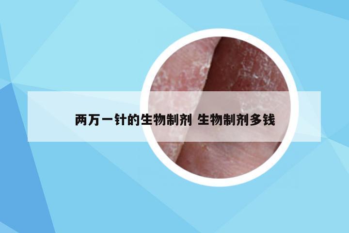 两万一针的生物制剂 生物制剂多钱