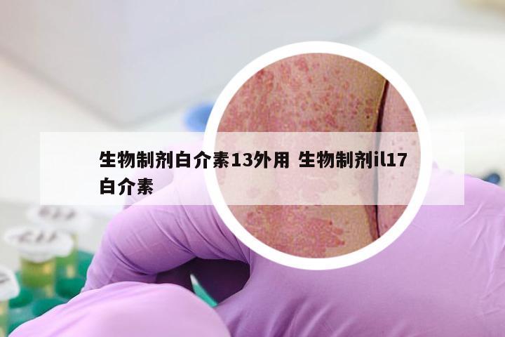 生物制剂白介素13外用 生物制剂il17白介素