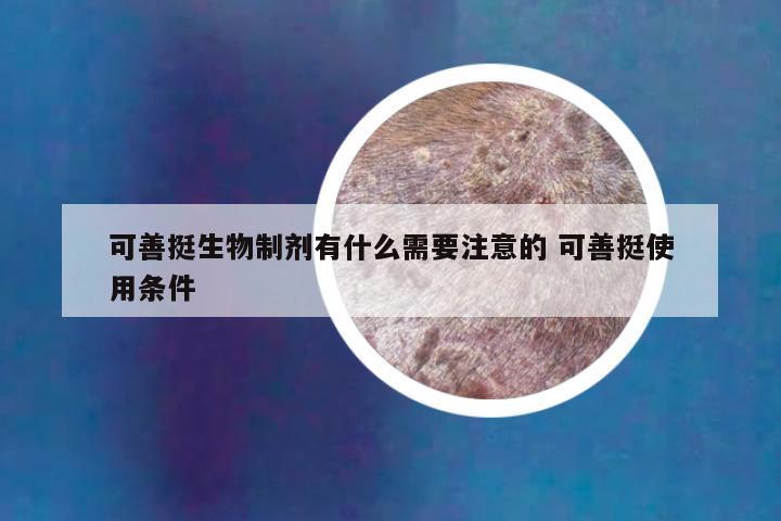 可善挺生物制剂有什么需要注意的 可善挺使用条件