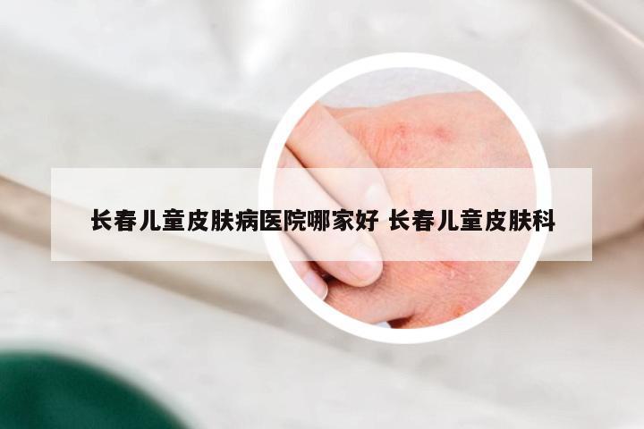 长春儿童皮肤病医院哪家好 长春儿童皮肤科