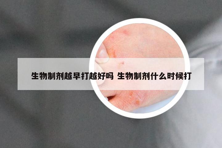 生物制剂越早打越好吗 生物制剂什么时候打