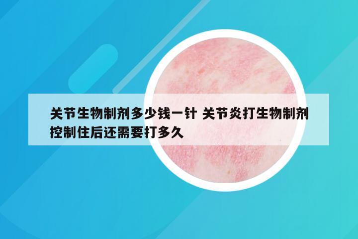 关节生物制剂多少钱一针 关节炎打生物制剂控制住后还需要打多久