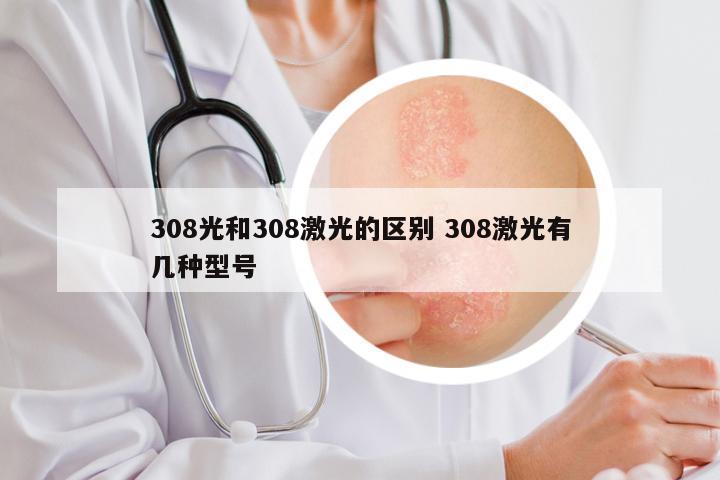 308光和308激光的区别 308激光有几种型号