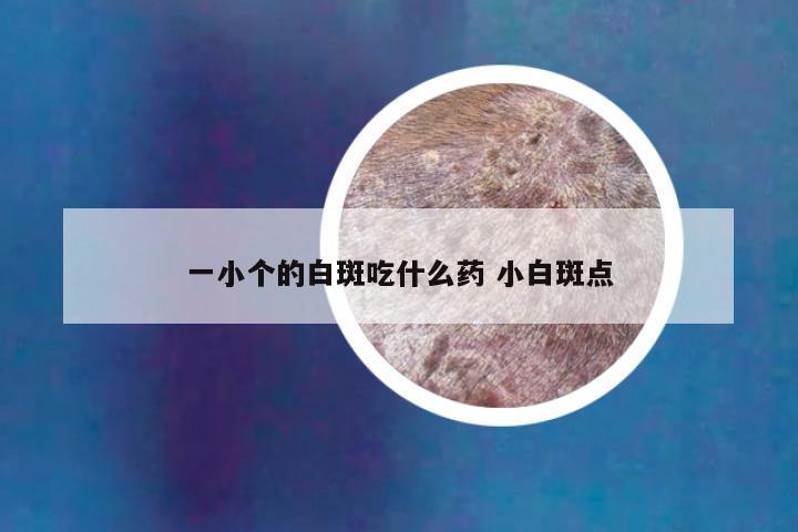 一小个的白斑吃什么药 小白斑点