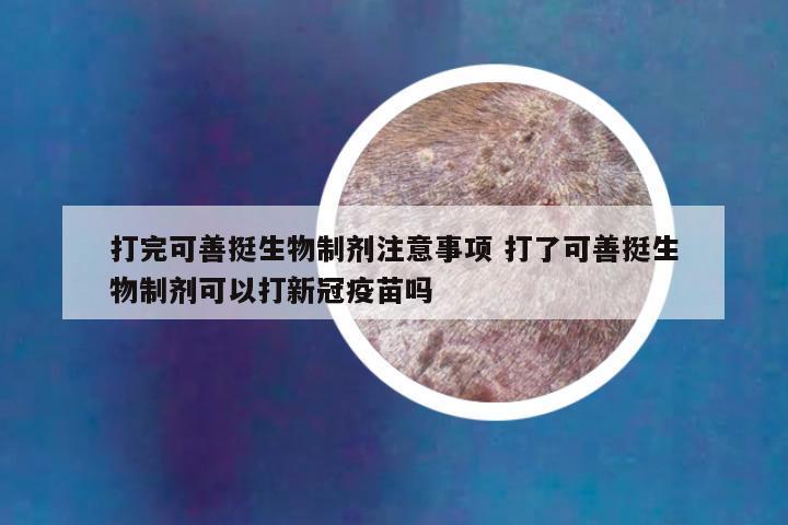 打完可善挺生物制剂注意事项 打了可善挺生物制剂可以打新冠疫苗吗